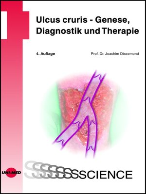 cover image of Ulcus cruris--Genese, Diagnostik und Therapie
